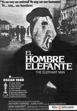 The Elephant Man picture