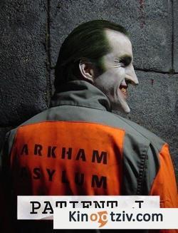 Patient J (Joker) picture