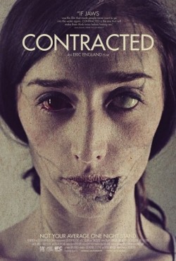 Contracted pictures.